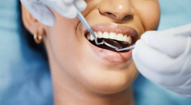 Best Same-Day Emergency Dental Services in Salinas, CA